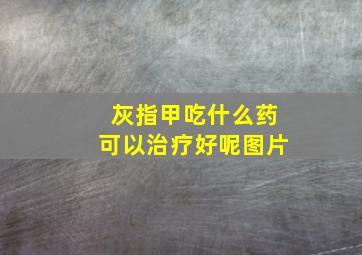 灰指甲吃什么药可以治疗好呢图片