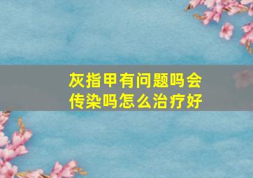 灰指甲有问题吗会传染吗怎么治疗好