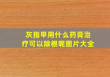 灰指甲用什么药膏治疗可以除根呢图片大全