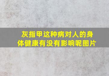 灰指甲这种病对人的身体健康有没有影响呢图片