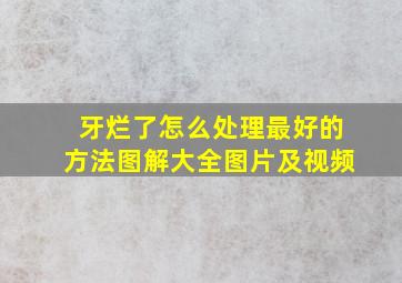 牙烂了怎么处理最好的方法图解大全图片及视频