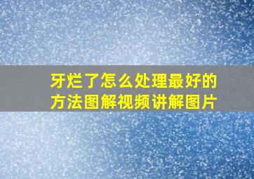 牙烂了怎么处理最好的方法图解视频讲解图片