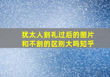 犹太人割礼过后的图片和不割的区别大吗知乎