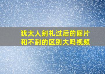 犹太人割礼过后的图片和不割的区别大吗视频