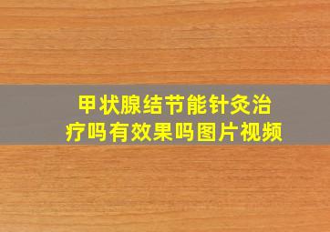 甲状腺结节能针灸治疗吗有效果吗图片视频