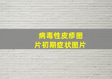 病毒性皮疹图片初期症状图片