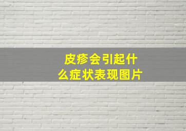 皮疹会引起什么症状表现图片