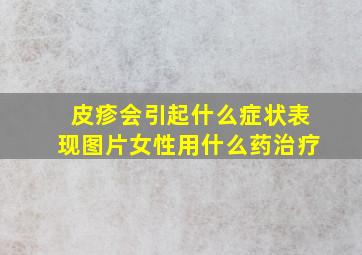 皮疹会引起什么症状表现图片女性用什么药治疗