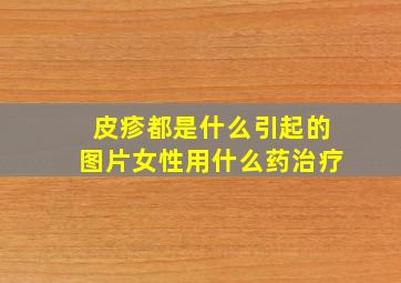 皮疹都是什么引起的图片女性用什么药治疗