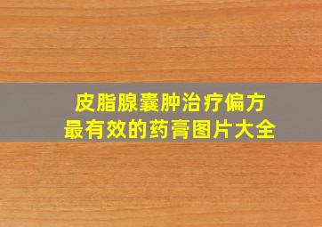 皮脂腺囊肿治疗偏方最有效的药膏图片大全