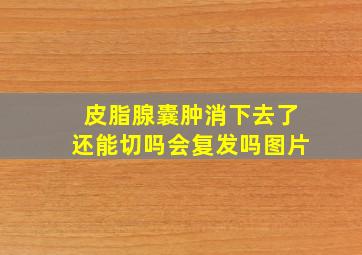 皮脂腺囊肿消下去了还能切吗会复发吗图片