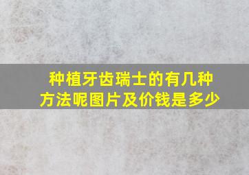 种植牙齿瑞士的有几种方法呢图片及价钱是多少