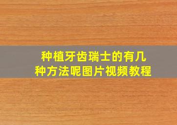 种植牙齿瑞士的有几种方法呢图片视频教程