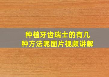 种植牙齿瑞士的有几种方法呢图片视频讲解