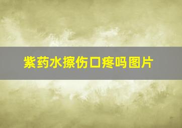 紫药水擦伤口疼吗图片