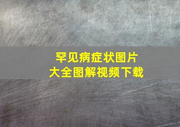 罕见病症状图片大全图解视频下载