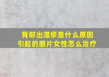 背部出湿疹是什么原因引起的图片女性怎么治疗