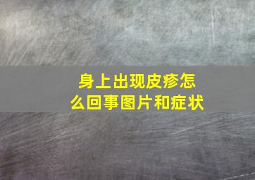 身上出现皮疹怎么回事图片和症状