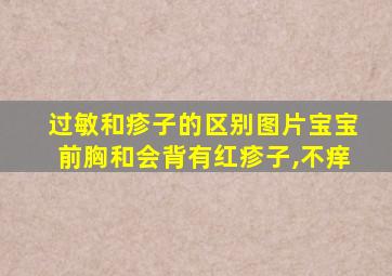 过敏和疹子的区别图片宝宝前胸和会背有红疹子,不痒