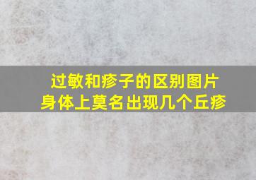 过敏和疹子的区别图片身体上莫名出现几个丘疹