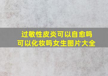 过敏性皮炎可以自愈吗可以化妆吗女生图片大全